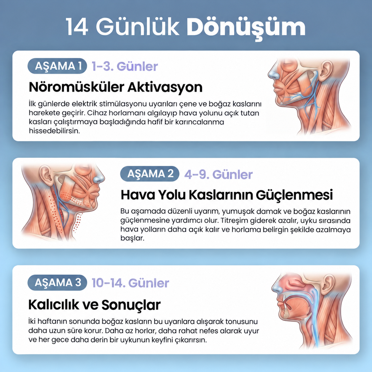 TheSilentSleep - Akıllı Ultrasonik Horlama Önleyici Cihaz