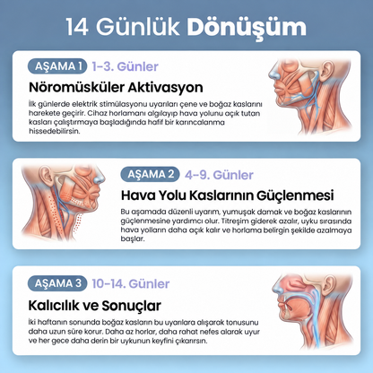 TheSilentSleep - Akıllı Ultrasonik Horlama Önleyici Cihaz